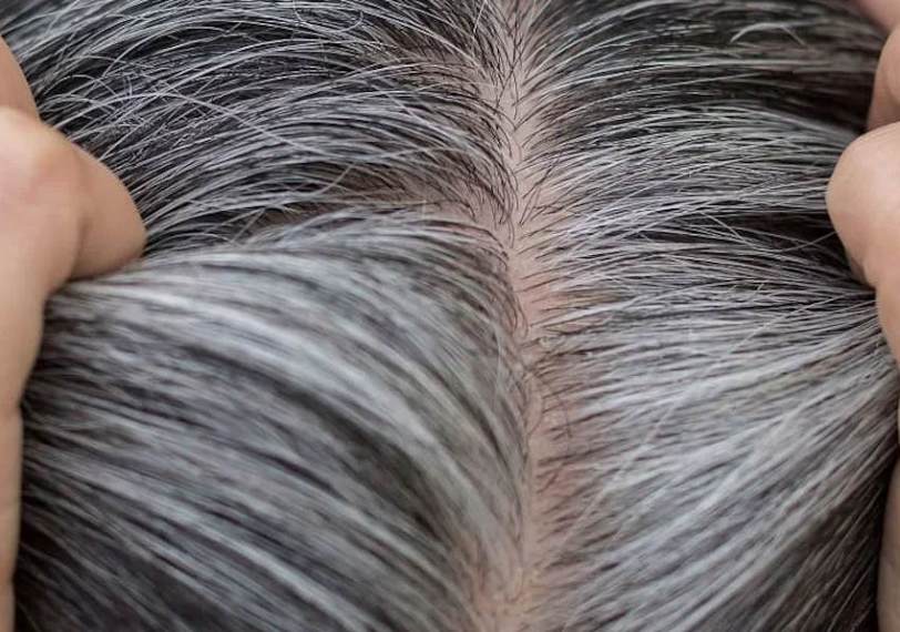 Saç Beyazlamasına Karşı Bitkisel Çözümler: Doğal Yollarla Genç Kalın!