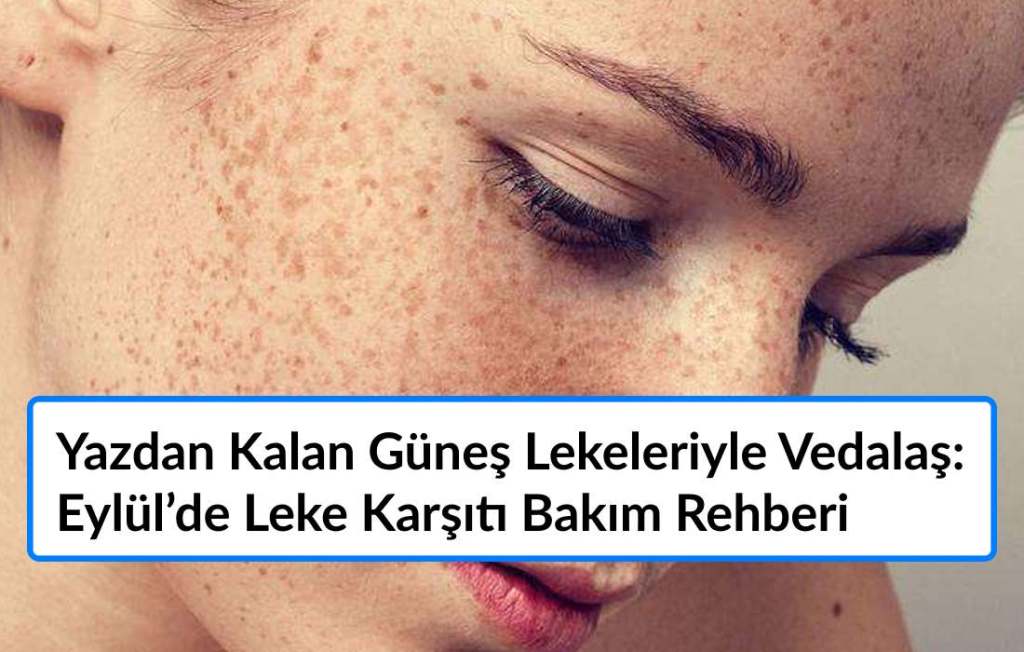 Yazdan Kalan Güneş Lekeleriyle Vedalaş: Eylül’de Leke Karşıtı Bakım Rehberi