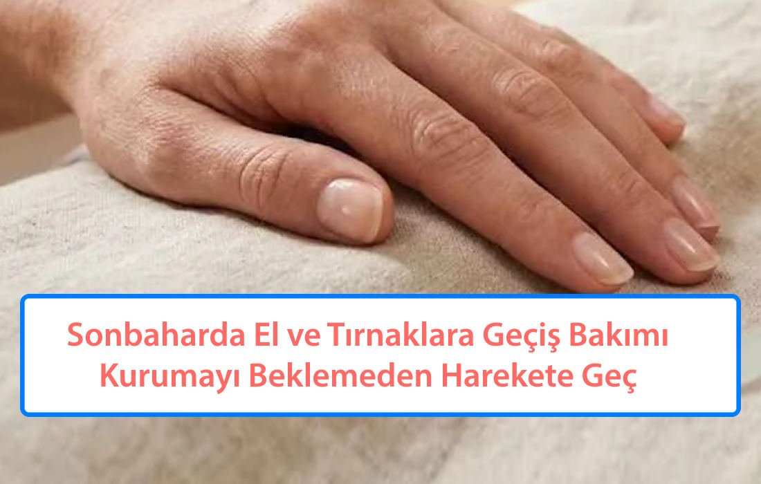 Sonbaharda El ve Tırnaklara Geçiş Bakımı: Kurumayı Beklemeden Harekete Geç